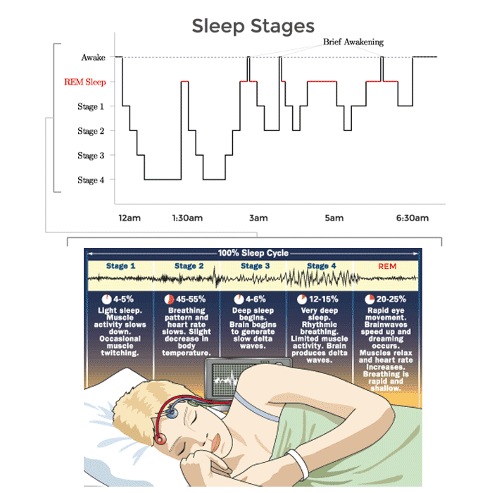 The Stages and Cycles within a nights sleep